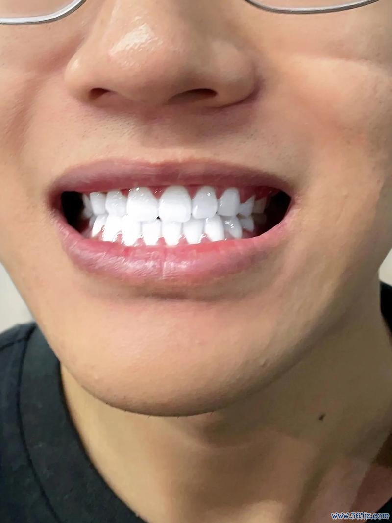 牙通牙最全游戏攻略解说_牙通牙最新游戏技巧通关